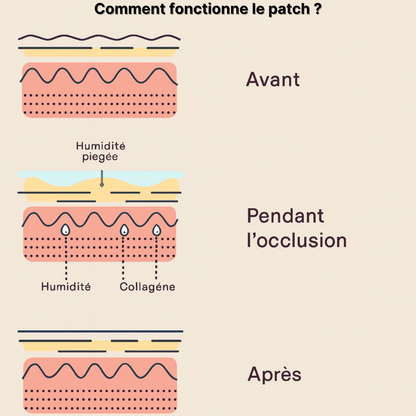 Patch Frontale Anti-Rides - 1 Patch d'Occlusion en Silicone réutilisable 30 fois