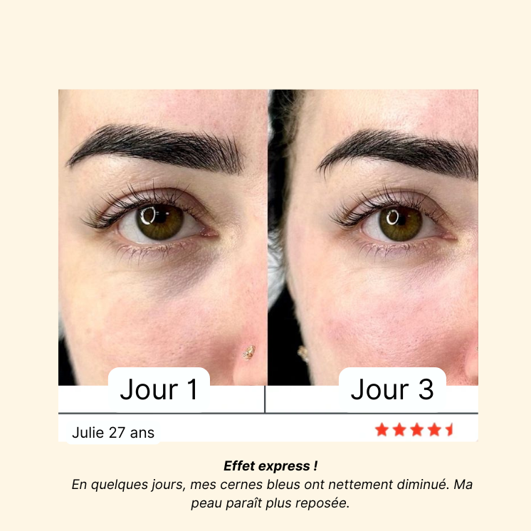 Soin Intégral 4-en-1 Anti-Cernes & Rides : Stylo LED et Crème Essentielle