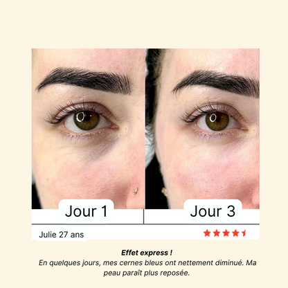 Soin Intégral 4-en-1 Anti-Cernes & Rides : Stylo LED et Crème Essentielle